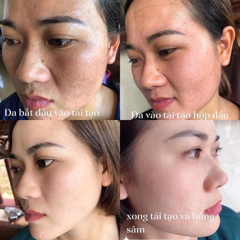 Combo 5 hộp kem tái tạo chamomileskill