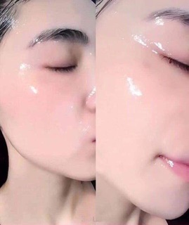 Mặt nạ nhau thai cuống rốn