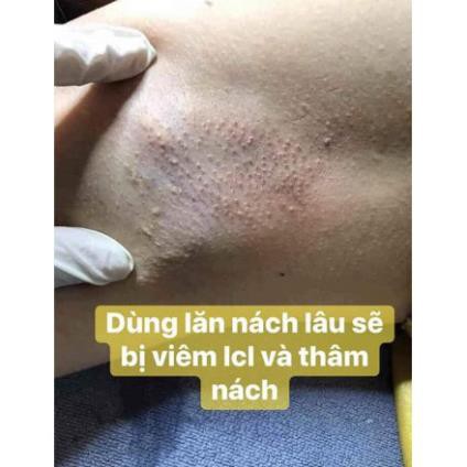 Xịt nách thanh mộc hương thảo dược chống vùng nách hôi chân [hàng chính hãng]