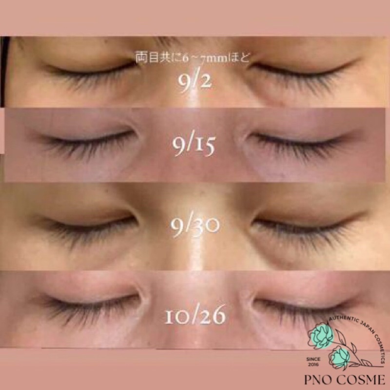 Serum dưỡng DÀI MI và DẦY MI Matsuge Omoi