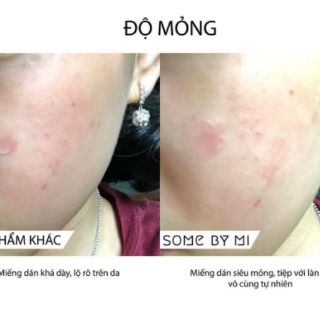 MIẾNG DÁN MỤN SOME BY MI CLEAR SPOT PATCH