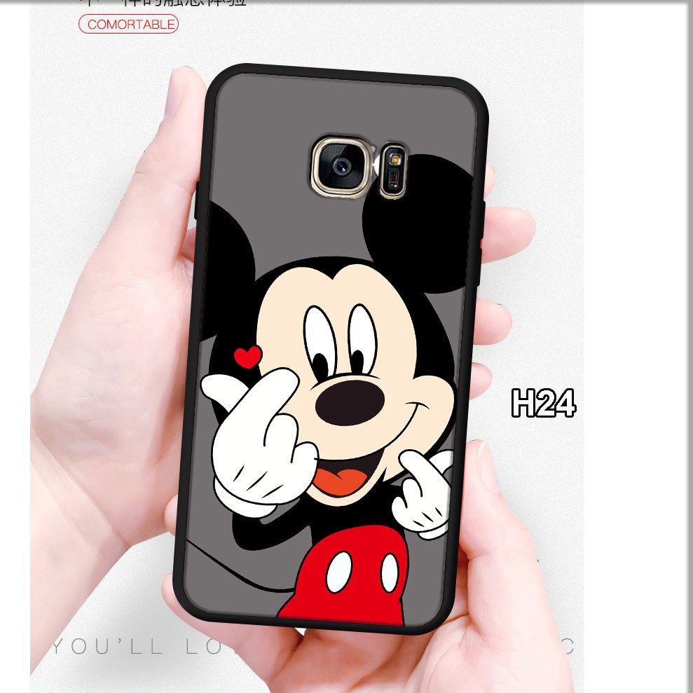 [ Hot ] Ốp lưng Samsung Note 5 - S6 - S6 Edge - S7 - S7 Edge in hình ngỗ nghĩnh | BigBuy360 - bigbuy360.vn