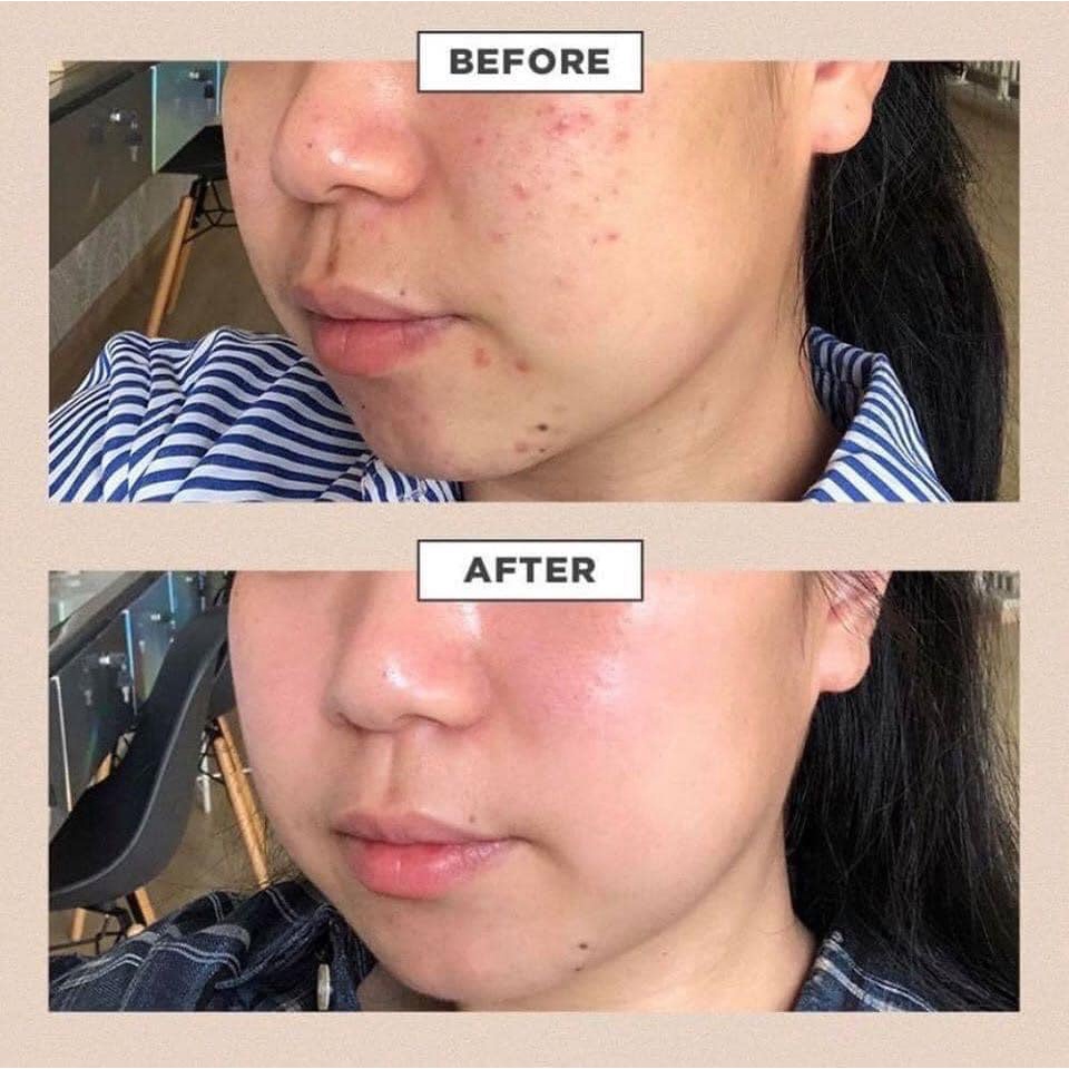 Kem Medi-Peel Centella tinh chất rau má phục hồi da