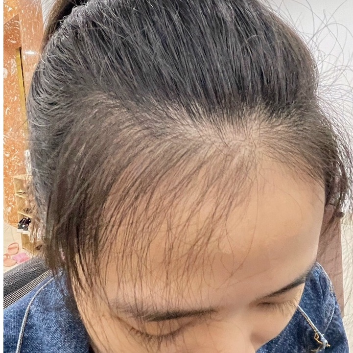 Xịt Kích Mọc Tóc Thảo Dược HAIR GREEN HERBER Quyên Lara ,Kích Mọc Tóc-Dưỡng Tóc -Ngăn Ngừa Rụng Tóc 120ml