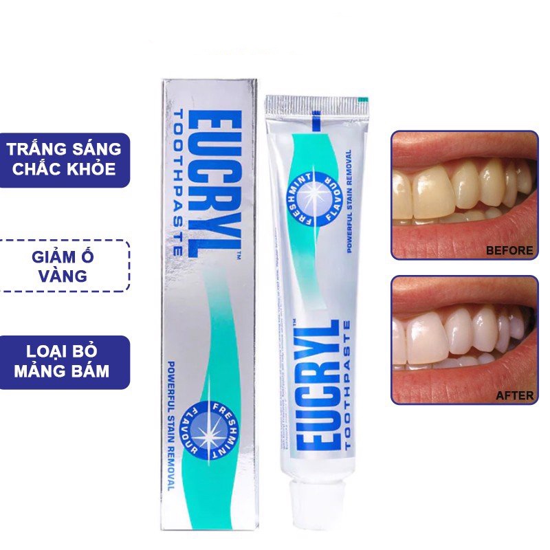 Kem đánh răng tẩy trắng Eucryl Toothpaste 62g giúp loại bỏ mảng bám làm răng trắng sáng