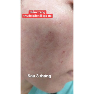 Thuốc Bắc Tái Tạo Da