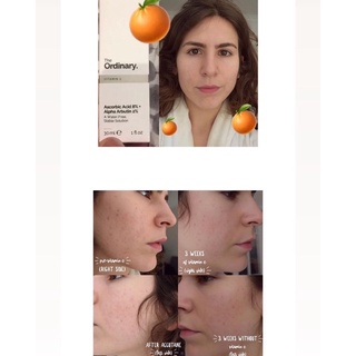 [Bill Sephora US] Serum sáng da, mờ nám The Ordinary Ascorbic Acid 8% + Alpha Arubtin 2%