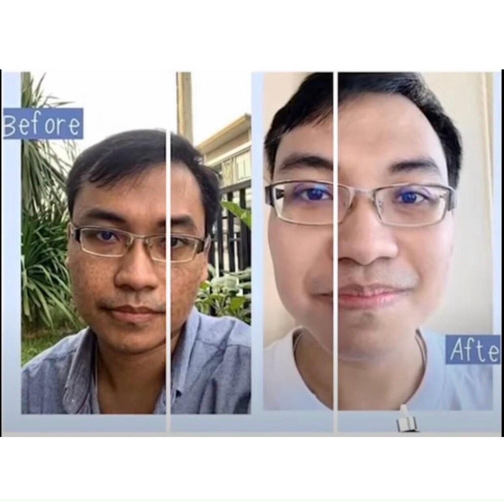 Serum Natcha - serum xóa nám, tàn nhang, xóa thâm giúp da đẹp, chính hãng,nội địa Thailand