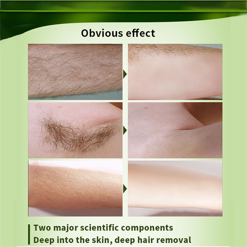 Kem tẩy lông vĩnh viễn thành phần tự nhiên chuyên dụng dành cho nam và nữ