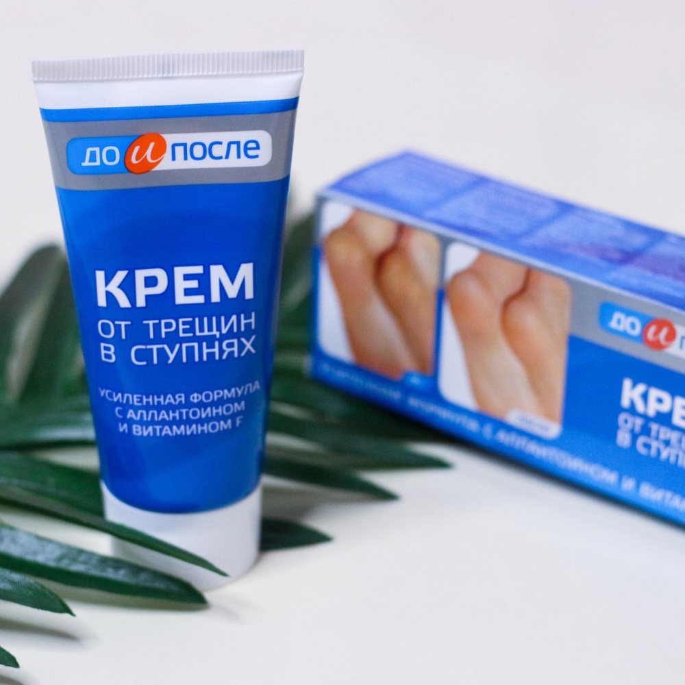 Kem Giảm nứt gót chân Kpem Apteka Nga 50ml Dưỡng Ẩm Làm Mềm Da Chân