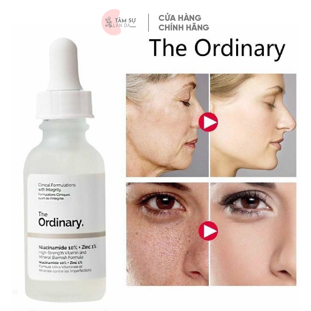 Serum The Ordinary Niacinamide 10% + Zinc 1% Giúp Cân Bằng Bã Nhờn Làm Sáng Da Thu Nhỏ Lỗ Chân Lông 30ml