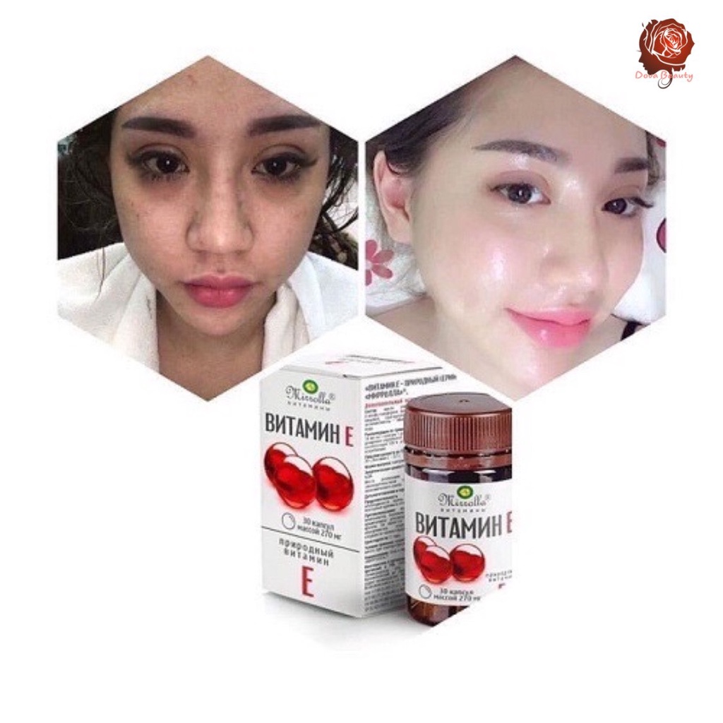 Vitamin E đỏ Mirrolla NGA 270mg Hàng Chính Hãng