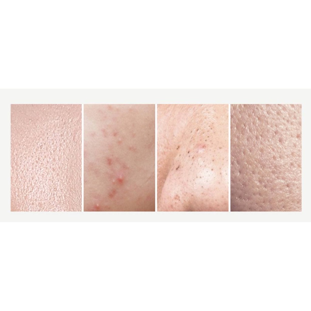 HŨ 120G GEL BHA/ SALYCILYC đắp mặt làm sạch các tế bào chết dư thừa trên da, tan dầu thừa, loại bỏ mụn ẩn, mụn đầu đen