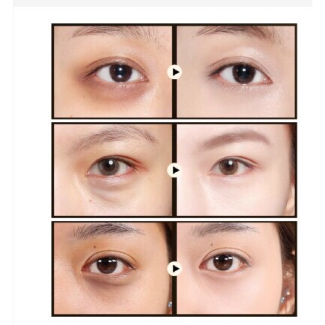 Mặt nạ mắt collagen giảm thâm quầng nếp nhăn hộp 60 miếng image