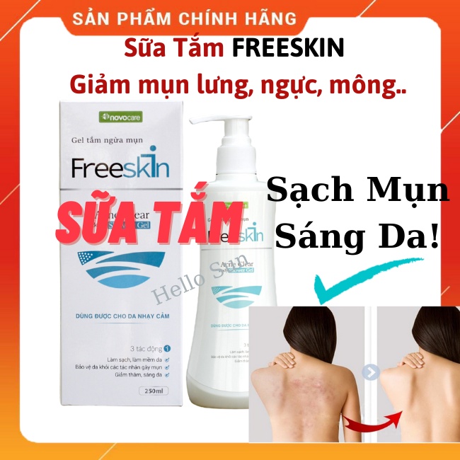 [CHÍNH HÃNG- BÁN CHẠY] Sữa Tắm Giảm Mụn FreeSkin Chai 250ml, Giảm Mụn, Mờ Thâm, Sáng Da, Hàng Chính Hãng