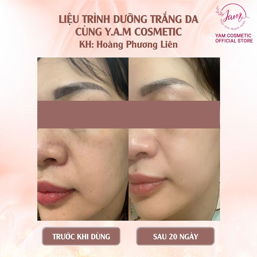 Bộ Dưỡng Trắng Sáng Da YAM Cosmetic Giúp Da Trắng Mờ Thâm Nám Hiệu Quả Serum 30ml Cream 30g