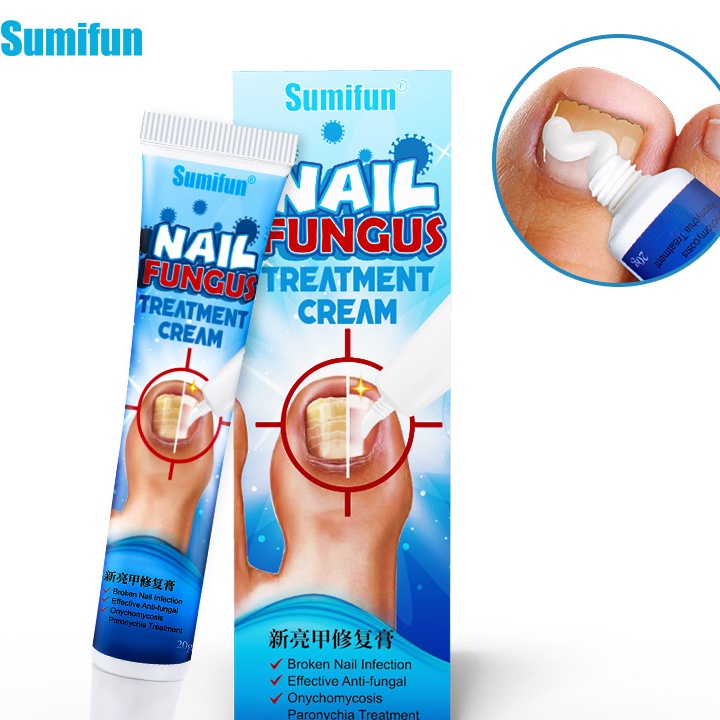 Gel kem giúp hết nấm làm thối móng tay móng chân KT2