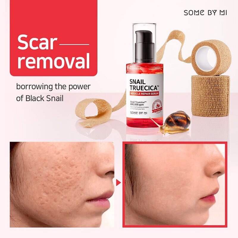Serum Ốc Sên Some By Mi Cải Thiện Sẹo Mụn Thâm Rổ Hiệu Quả Snail Truecica Miracle Serum 50ml - Khongcoson