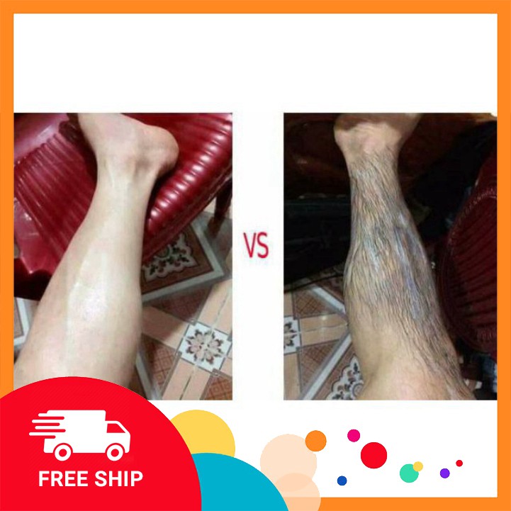 Gel tẩy lông Drose KHÔNG ĐAU KHÔNG RÁT | BigBuy360 - bigbuy360.vn