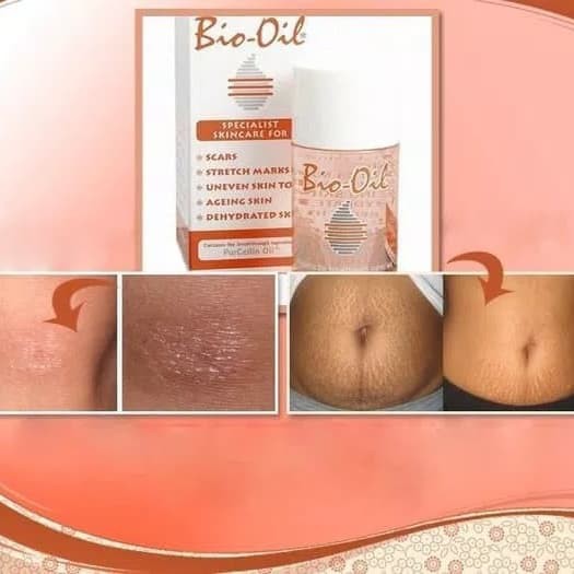 (hàng Mới Về) Tinh Dầu Bio Oil 200ml Trị Sẹo Chăm Sóc Da Dung Tích 200ml