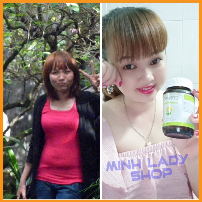 Viên Uống Trắng Da Dian Beauty, [Mua 1 Tặng 2] ,Mua 2 Giảm thêm 59K, FreeShip, Trắng toàn thân, mờ nám | BigBuy360 - bigbuy360.vn