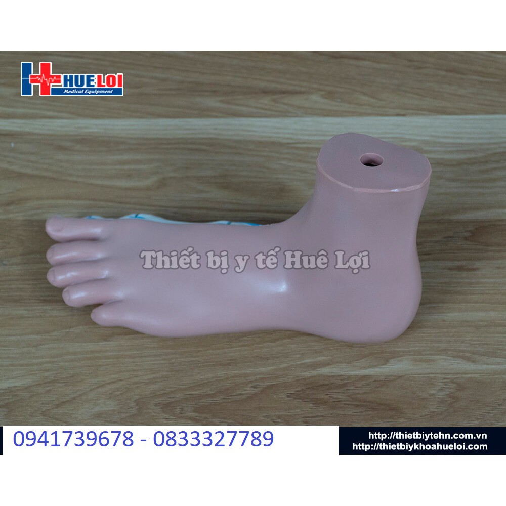 Mô hình bàn chân bệnh lý