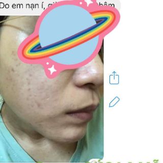 Serum cúc la mã