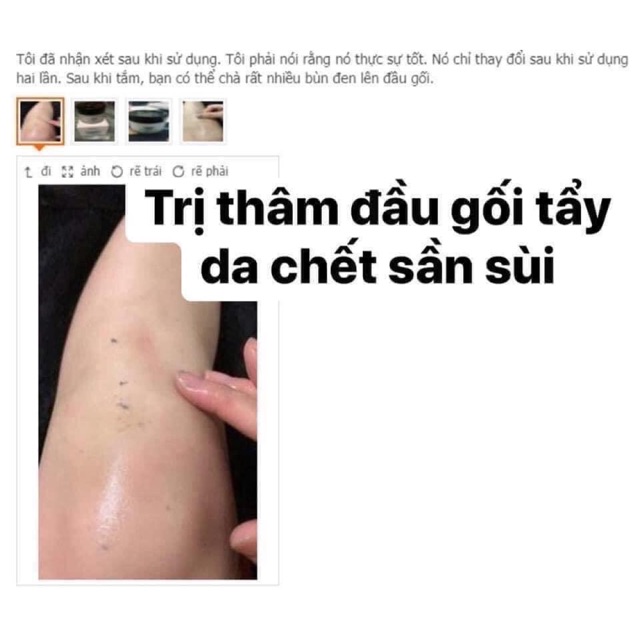 Kem trị thâm nách và đầu gối
