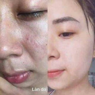 BỘT CÁM GẠO CAO CẤP.ANTHY
