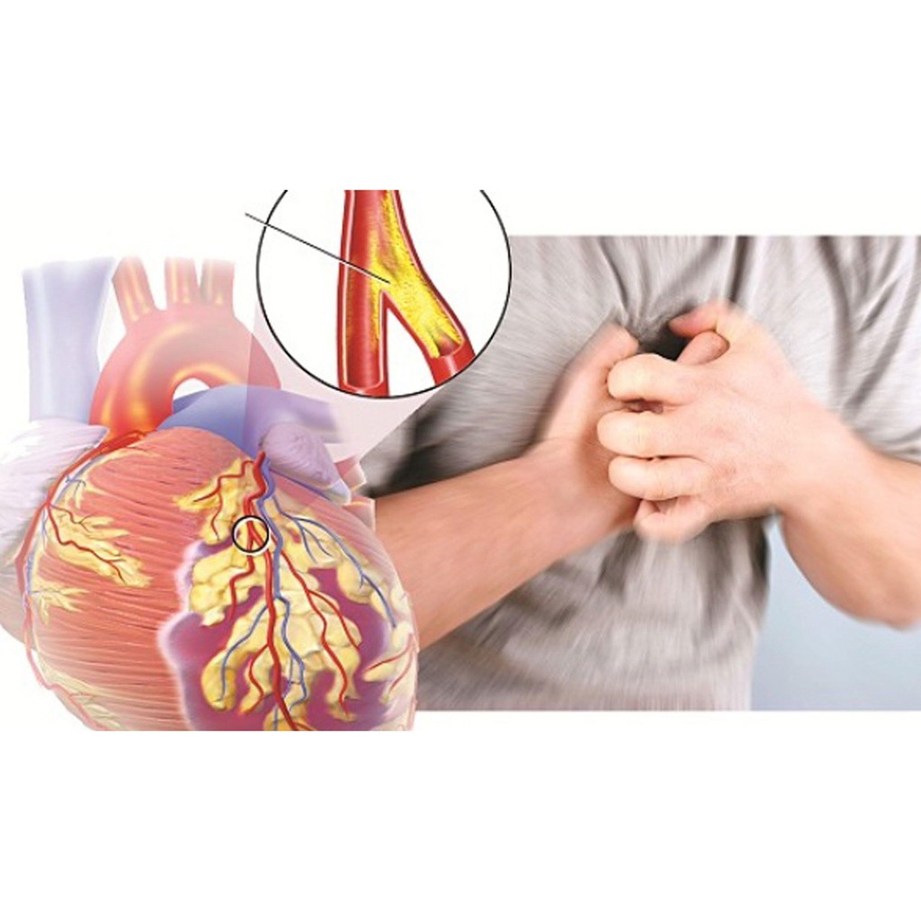 Vương Tâm Thống - Giúp giảm hình thành huyết khối, hỗ trợ tăng cường lưu thông máu (Hộp 30 Viên)