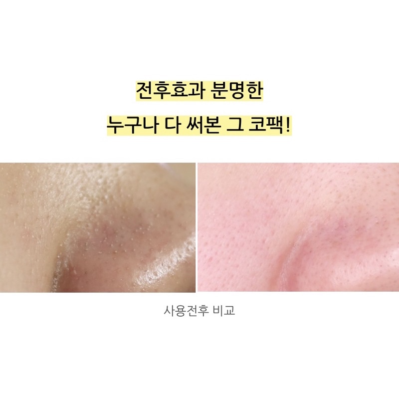 Miếng dán lột mụn đầu đen HATHERINE Pore Clear Black/ White/ Teatree Nose Strip