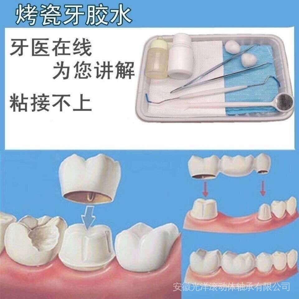 Keo dán răng sứ giả bảo vệ răng miệng DIY