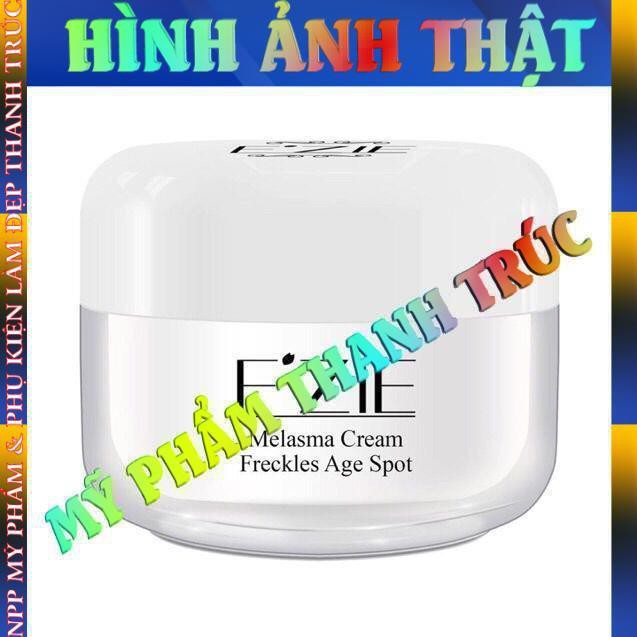 Kem mờ thâm nám tàn nhang Ezie Melasma Cream Freckles Age Spot 50g