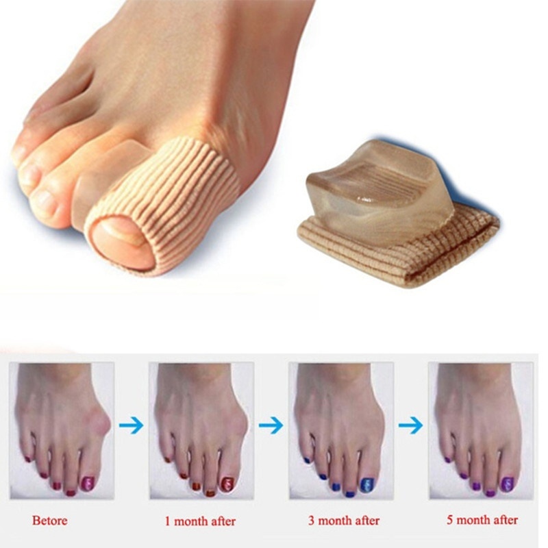 1 Pair Orthopedics Bunions Foot Care Pedicure Silicon Pad Protection Toe Spreader Hallux Valgus Feet Care Tool