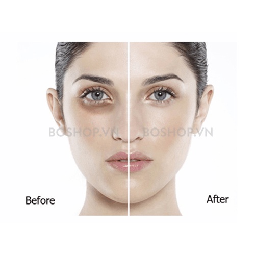 Kem Giảm Quầng Thâm Mắt Hadariki Kumargic DX Eye Cream 20g