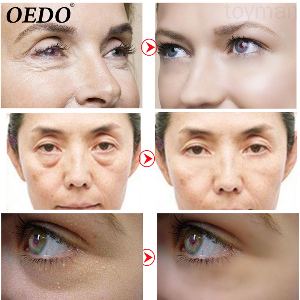 [Hàng mới về] Mặt nạ dưỡng da mắt collagen pha lê vàng chống lão hóa và quầng thâm