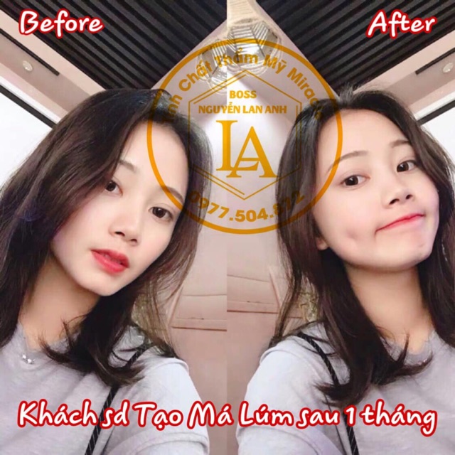 Tinh Chất Tạo Má Núm Đồng Tiền Miracle