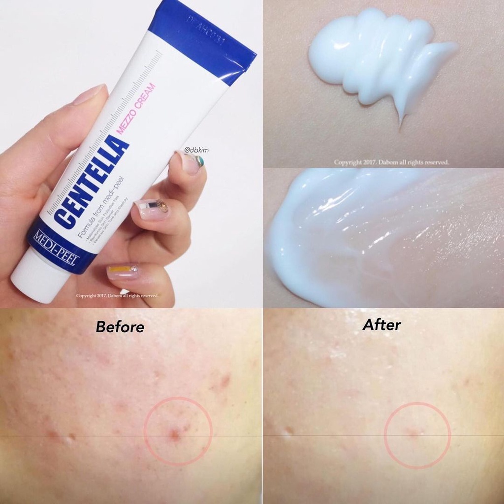 Kem Dưỡng Medi Peel Centella Giảm Mụn Phục Hồi Da Rau Má - Tuýp 30ml