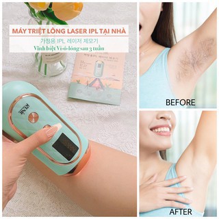 MÁY TRIỆT LÔNG LASER IPL GENIE KOREA [Chính Hãng] Không Đau ,Không Rát ,Hiệu Qủa.