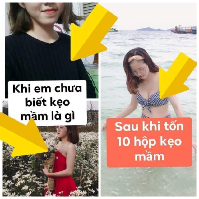 Giảm giá Combo 4 hop kẹo mầm lúa mạch gold của thảo mộc 37 tăng saiz vòng 1 từ 2 đến 5cm chỉ sau 1 liệu trình