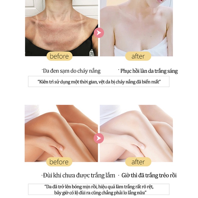Sữa rửa mặt bùn biển sâu Làm trắng nhanh chóng Tẩy da chết Làm sạch sâu lỗ chân lông Thu nhỏ lỗ chân lông Dưỡng ẩm