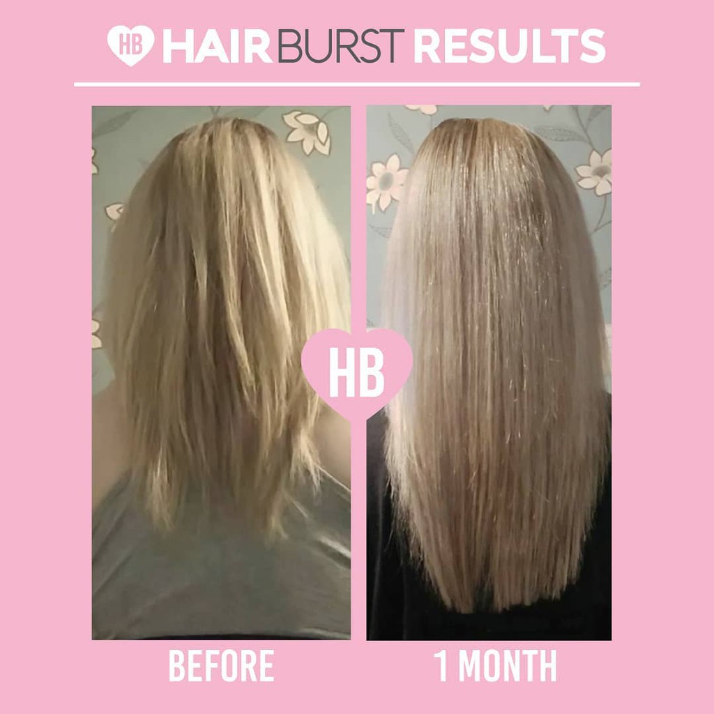 Cặp dầu gội xả Hairburst For Longer Stronger Hair Shampoo and Conditioner