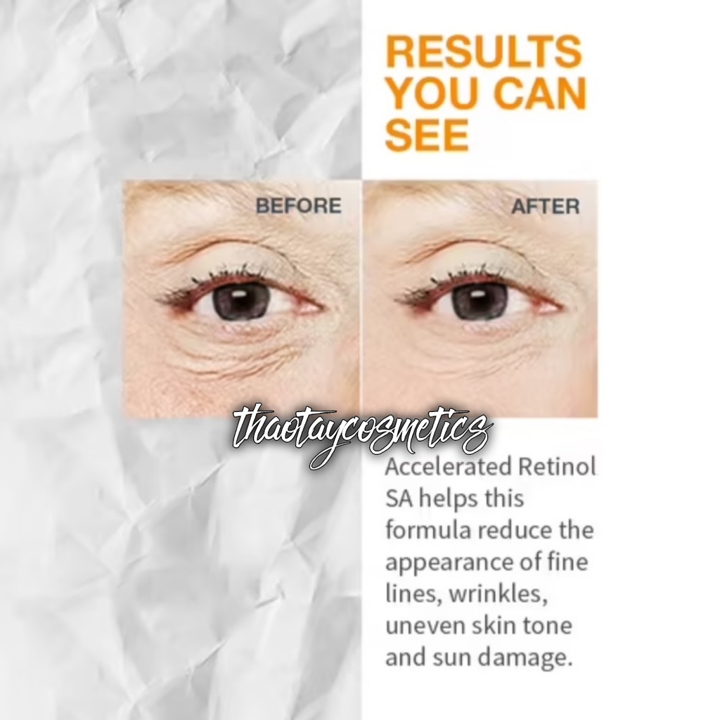 Kem dưỡng sáng giảm nhăn vùng mắt Neutrogena Rapid Wrinkle Repair Eye Cream