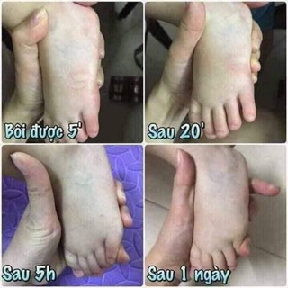 Cao bôi muỗi Xả Thái Lan