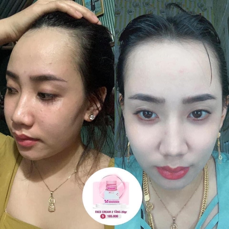 [Chính Hãng] Kem Face 2 Tầng Myô