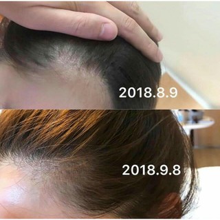 SET GỘI XẢ ARGAN BAOBAB RAON
