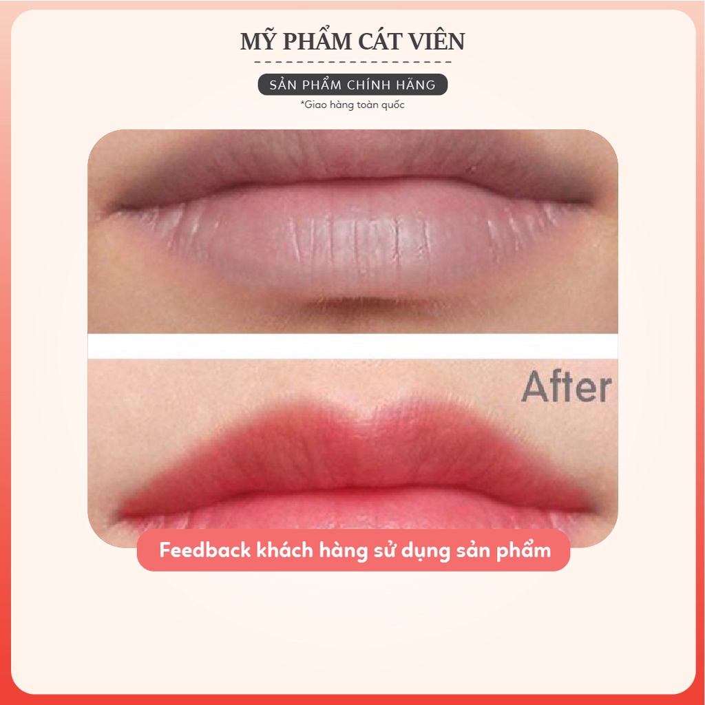 Son dưỡng kích màu Vip Collagen, sử dụng sau phun xăm, giúp giảm thâm, giữ màu môi bền, đẹp hơn - 5 tuýp