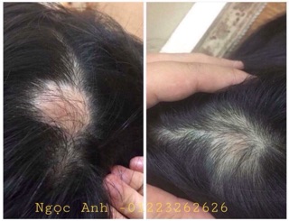 Combo Thảo Dược Gội Đầu và Xả Mộc