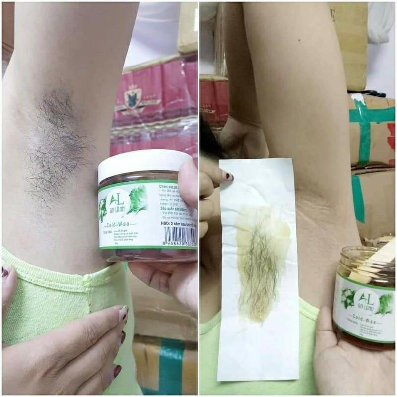 Combo sáp wax lông và mỡ trăn An Lành giúp tẩy triệt lông vùng kín bikini nách chân tay body toàn thân vĩnh viễn tại nhà