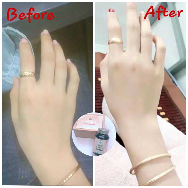 [ SALE 13% ] Viên Uống Trắng Da Nhập Khẩu Mỹ | BigBuy360 - bigbuy360.vn